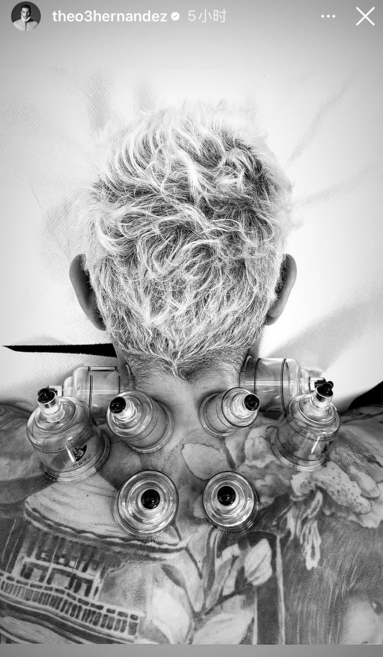 神秘東方力量加持？特奧社媒曬照，自己正在接受拔罐治療